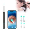 Rechargeable Ear Cleaner Wireless Visual Ear Wax Remover Ear Picking