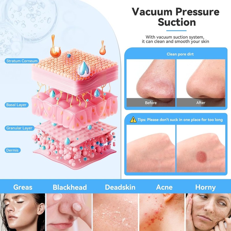 Upgraded Diamond Micro Hair Removal Facial Machine Professional Deep Clearing