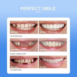 Dientes postizos - Gel - 1 unidad - Mejora la apariencia con un conjunto completo de dientes para una sonrisa más radiante