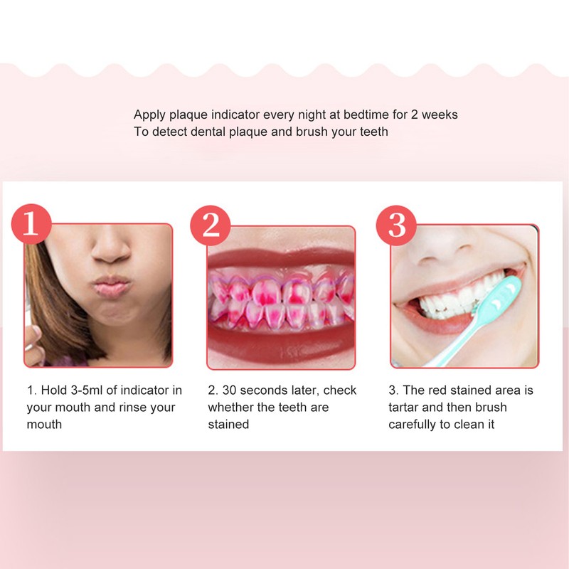 Plaque Disclosing Agent Oral Tartar Test Examination Dental Plaque Indicator
