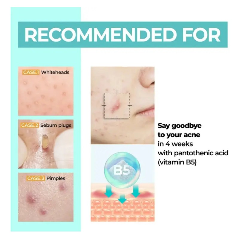 Kit Numbuzin 1 Pantothenic B5 Active Soothing Serum Y Crema
