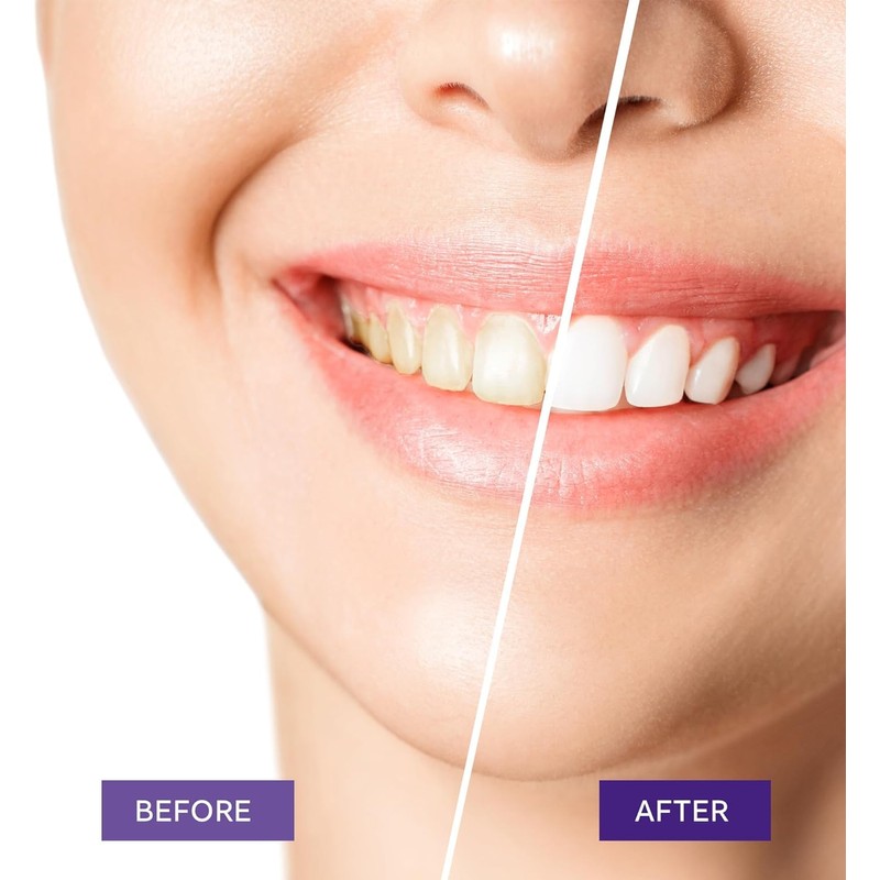 Purple Toothpaste for Teeth Whitening, Purple Teeth Whitening Toothpaste, Purple