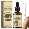 Weihrauchöl, Frankincense Oil for Face, Kommt mit 1 Massagestab, Feuchtigkeitsspendend,