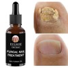 손톱 에센스 리페어 발톱 [9] Nail Essence Repair Toe Nails