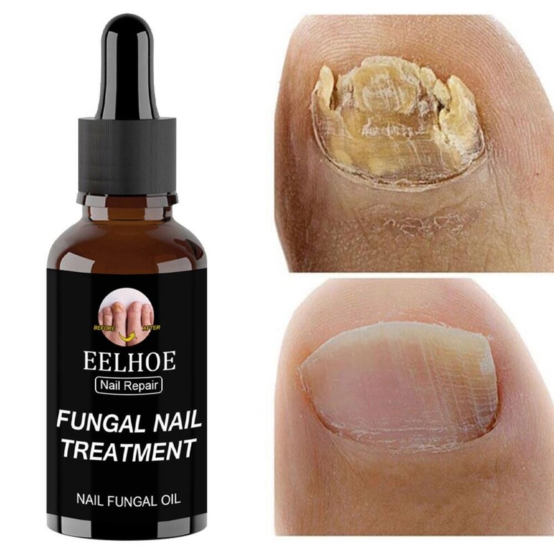 손톱 에센스 리페어 발톱 [9] Nail Essence Repair Toe Nails