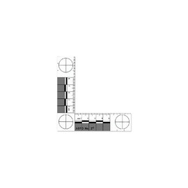 ABFO NO.2 Bitemark Scale