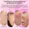 Crema Facial Arbutin 7% + Ácido Tranexámico 4% Crema De