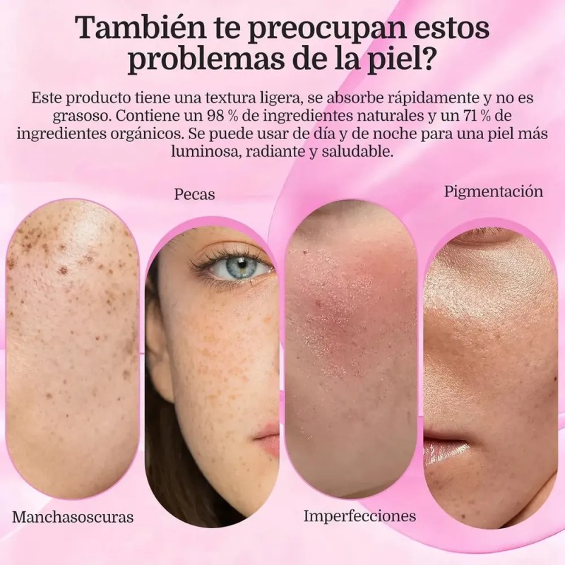 Crema Facial Arbutin 7% + Ácido Tranexámico 4% Crema De