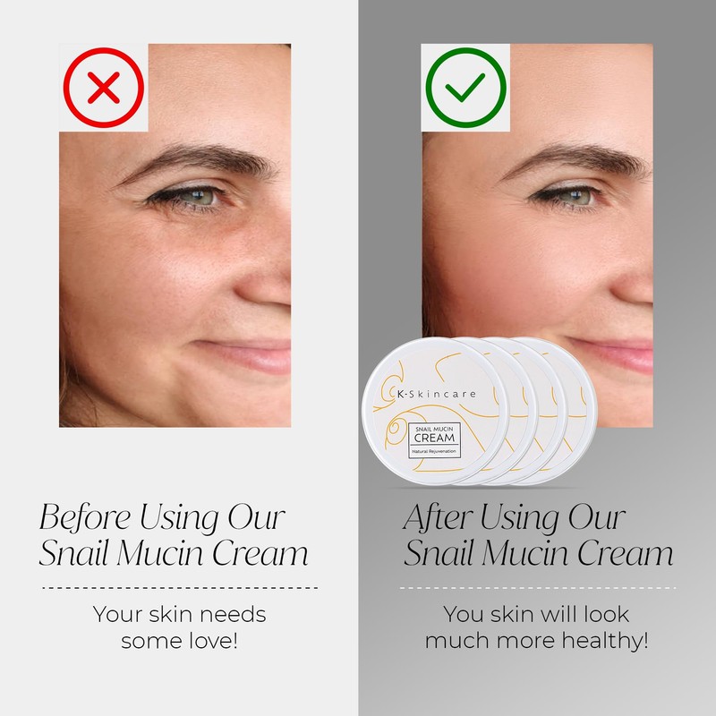x4 Premium Snail Mucin Essence Cream with Hyaluronic Acid –