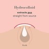 a.l.m. Magical Patch: Hydrocolloid pimple patches. These ultra thin &