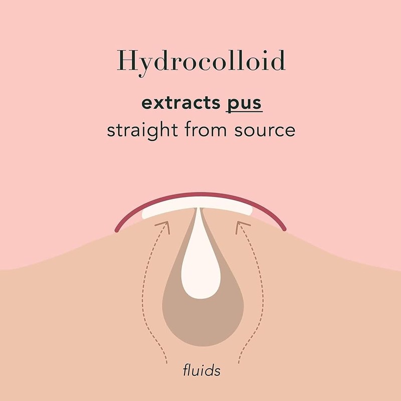 a.l.m. Magical Patch: Hydrocolloid pimple patches. These ultra thin &