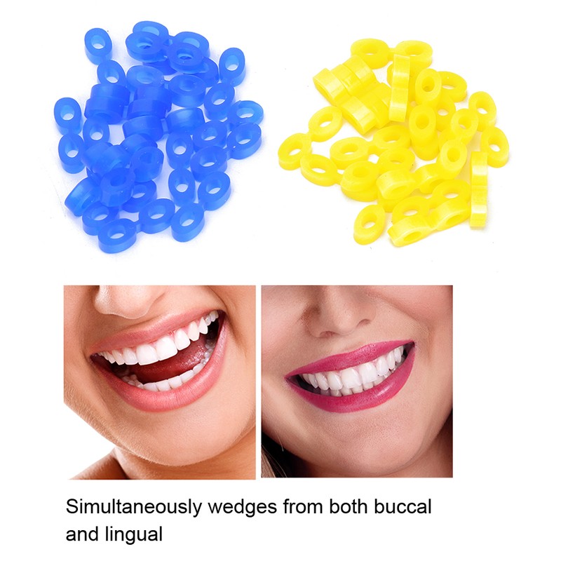 Dental Rubber Elastics Wedges Dental Elastic Fixing Wedges Dentist Material