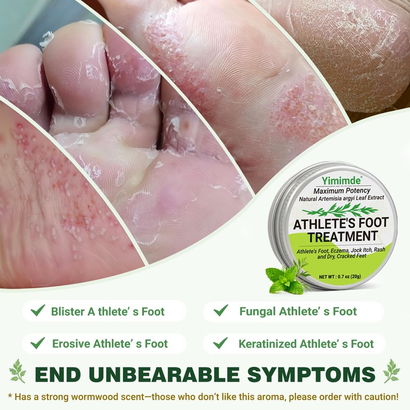 yimimde Potency Athlete's Foot Treatment Cream, 0.7oz (Pack of 1)