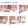 1pc Silver Ingrown Toenail Correction 17 to 22mm Adjustable Stainless