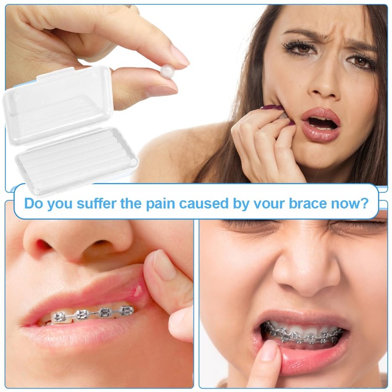 XUKZIMA 2 Boxes Orthodontic Wax for Braces Dental Wax for