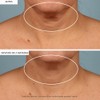StriVectin-TL - Crema para el cuello, 1.7 Fl. Oz, 1.7