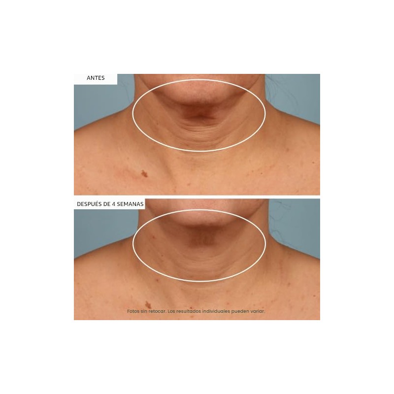 StriVectin-TL - Crema para el cuello, 1.7 Fl. Oz, 1.7