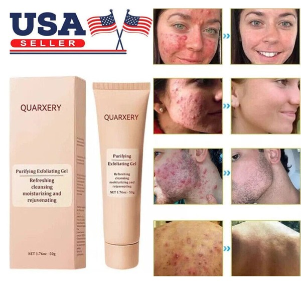Unbranded Purifying Exfoliating Gel, Quarxery Purifying Cream for Face &