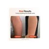 Strawberry® Crema Rejuvenecedora Para Queratosis Pilaris Kp