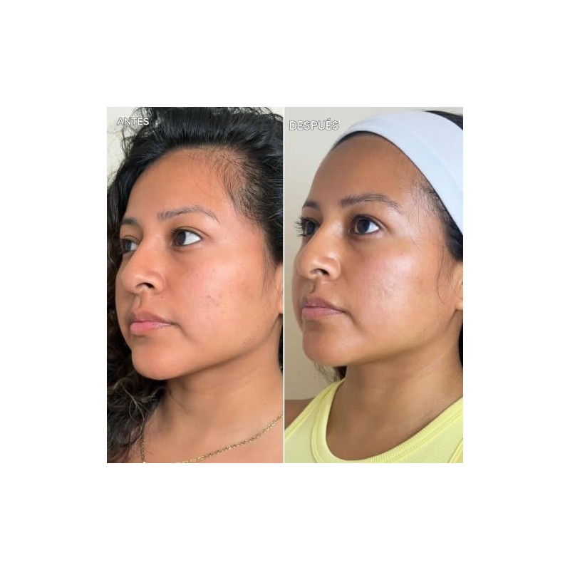 DERMISA CREMA PARA MANCHAS CON VITAMINA C Y EXTRACTO DE