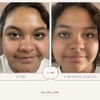 Serum Facial Piel Grasa, Oil Control, NIACINAMIDA (vit B3), Noni,