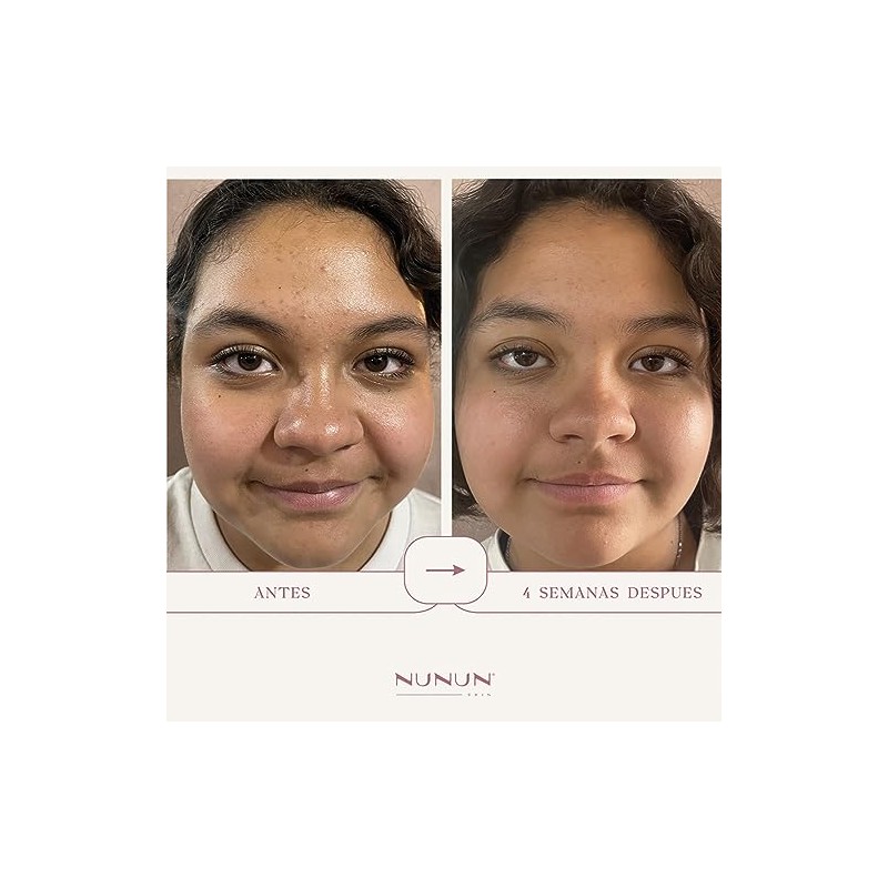 Serum Facial Piel Grasa, Oil Control, NIACINAMIDA (vit B3), Noni,