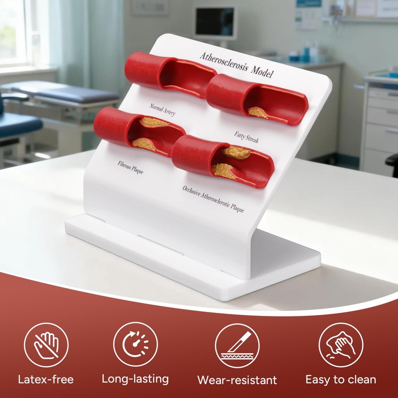 Simedutech Atherosclerosis Model, Artery Plaque Display,Vascular Disease