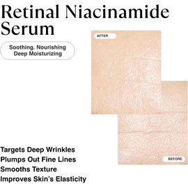 MATKAS Korean 0.05% Retinal + 5% Niacinamide Serum for Wrinkles - 30mL, Korean Retinol Serum for Face Anti Aging, Best Retinol Infusion for Face Wrinkles Dark Spots, Night Treatment for Women