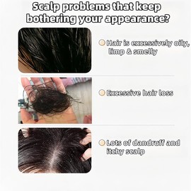 REMIMPI Anti-Hair Fall Hair Loss Treatment Shampoo Oil Control Anti dandruff Haircare Ginseng Ginger Help Hair Growth Jojoba Oat Repair Reduce Hair Loss Scalp Cleanser Conditioner 300ML【Buy 1 Get 1 Free】