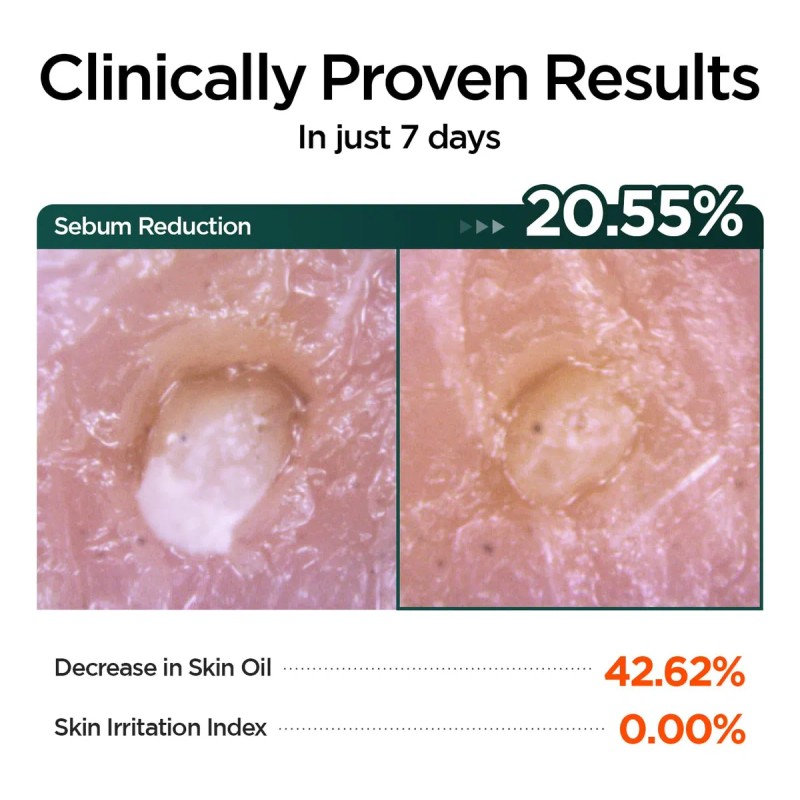 P.calm Barrier Cycle Daily Sheet Mask - Hojas De 30