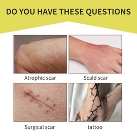 Tattoo Cover Up Patch, Tattoo Cover Up Tape, Ultra Thin Patch for Scar and Birthmarks, Invisible Waterproof Skin Tone Concealer Sticker for Covering Up Scars Tattoos, 6 Pcs - Medium Skin