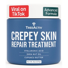 TreeActiv Tratamiento reparador de piel Crepey, fórmula original, 8 fl oz, crema reafirmante para rostro y cuello, loción reafirmante para la piel con ácido hialurónico, tratamiento para piel Crepe