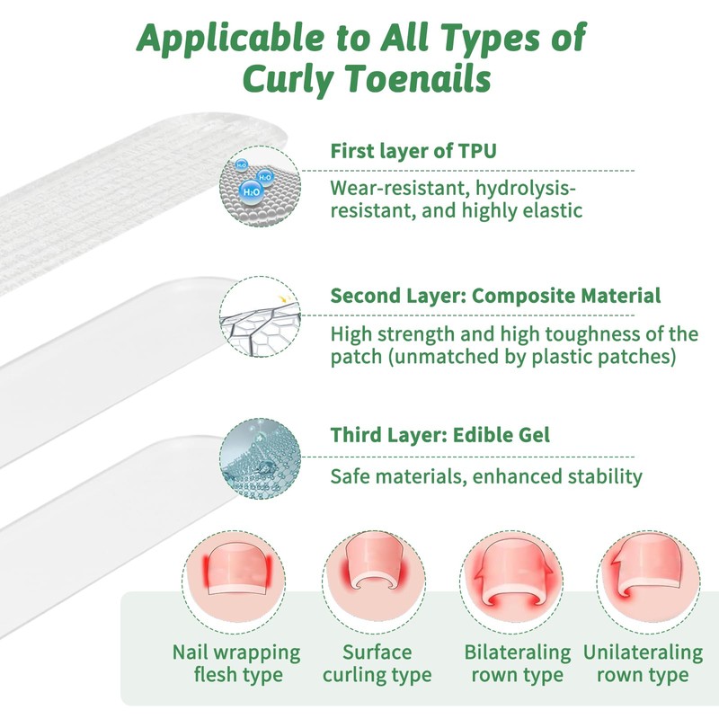 144 x Nail Clips/Toenails/Nail Correction Clips Toenail 4 x 24