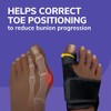 Dr. Scholl's Bunion Relief & Toe Corrector, 1 support set