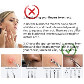 22 Pcs Pimple Popper Tool, Blackhead Remover Acne and Zit Comedone Extractor Kit