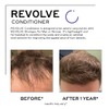 ZENAGEN Revolve Conditioner (Unisex) | Supports Scalp Health & Appearance