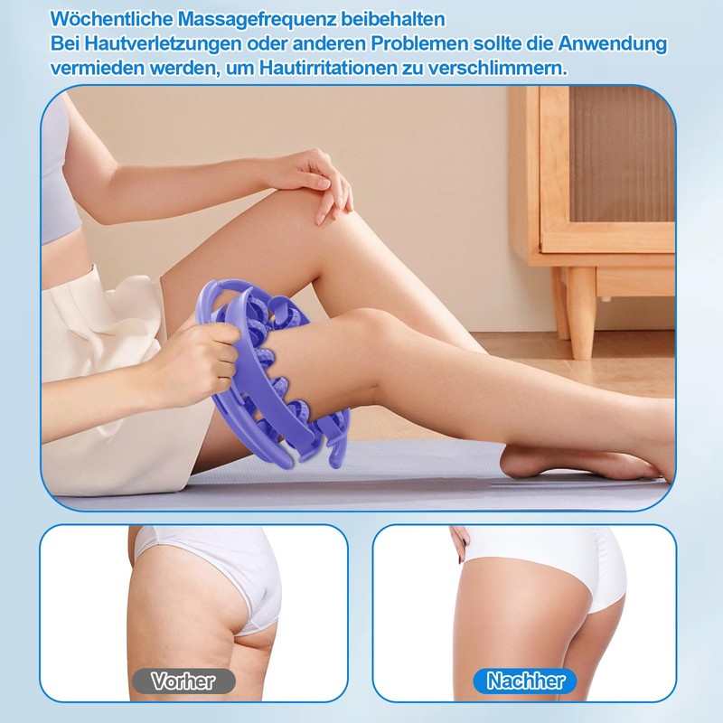 Dufuso Manual Anti-Cellulite Massager