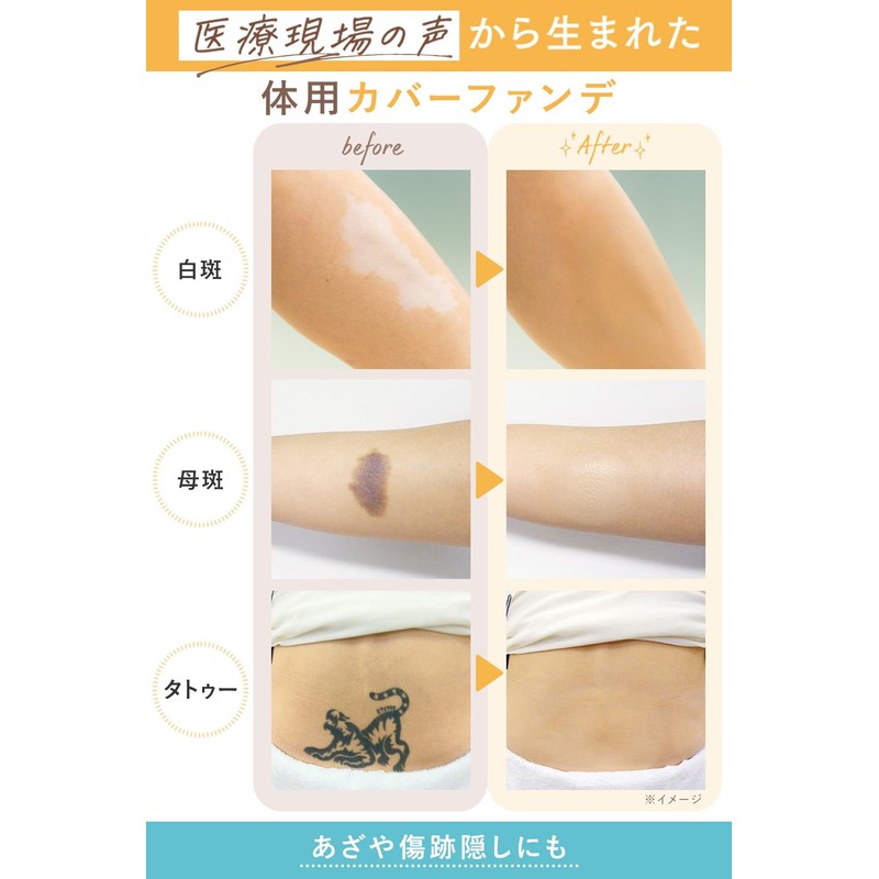 【Official】Marshfield SC Body Cover Foundation N Body Foundation for Bruises,