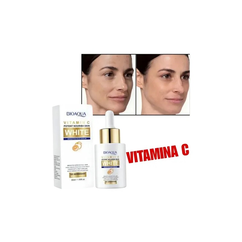 Serum Aclarante Manchas Acné Tratamiento Vitamina C 30m