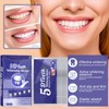 Teeth Whitening Strips Bleaching Teeth, Whitening Teeth Strips, Effective and
