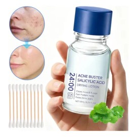 Acne Buster Loción Secante Con Ácido Salicílico 10ml Todo Tipo De Piel Díanoche                                                                       