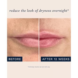 City Beauty City Lips - Aceite nocturno para rellenar, hidratar y restaurar durante la noche, tratamiento labial antienvejecimiento, aceite labial aco