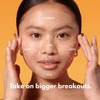 Mighty Patch Face from Hero Cosmetics - XL Hydrocolloid Mask