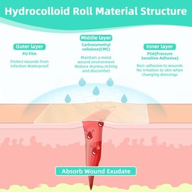 MFLRYA Hydrocolloid Roll for Wound Care - Cut-to-Size, Extra Large Hydrocolloid Patch Bandages with Self-Adhesive, Ultra Absorbent, Flexible & Waterproof, First Aid Kit Essential (2in*16ft, 19.7mil/ 0.5mm Thickness) Healthcare acne pimple patch bandaids
