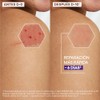 A-Derma Epitheliale Ultra Repair Crema Reparadora Cicatrizante, 40ml