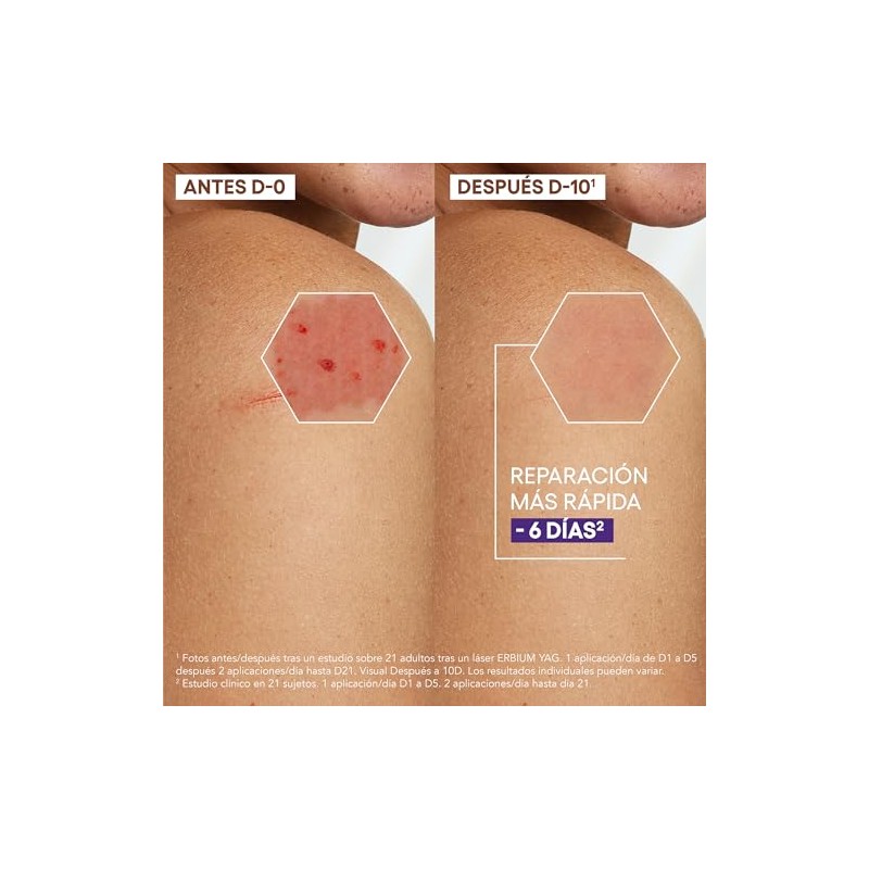 A-Derma Epitheliale Ultra Repair Crema Reparadora Cicatrizante, 40ml