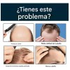 Esencia Anticaída Para El Cuidado Del Cabello Masculino-3pcs