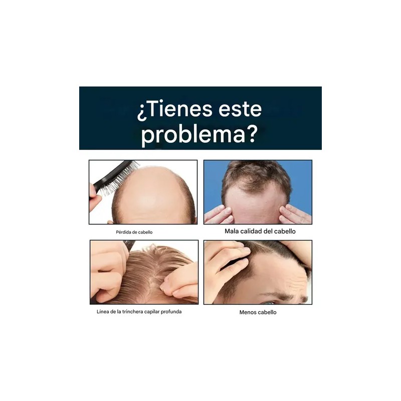 Esencia Anticaída Para El Cuidado Del Cabello Masculino-3pcs