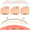 60Pcs Ingrown Toenail Patches, Durable Toe Separators, Breathable Fungal Nail