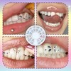 Tooth Gems Kit, DIY Teeth Gem Kit, Fashionable Removable Tooth